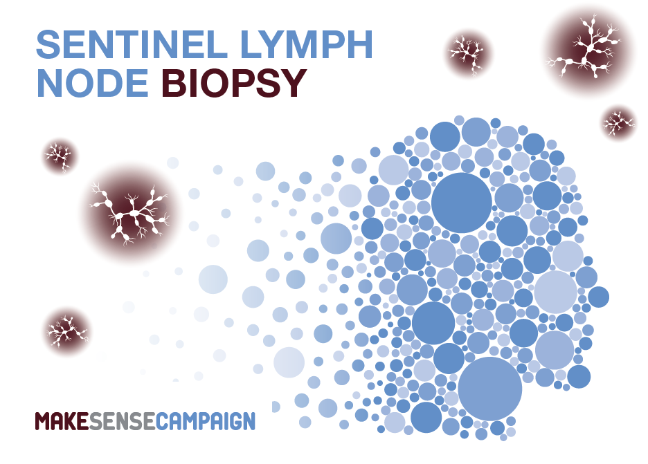 What Is Sentinel Lymph Node Biopsy Norgine What Is Sentinel Lymph Node Biopsy Norgine